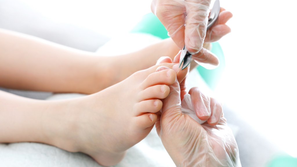 podologo arreglando una uña encarnada a un paciente